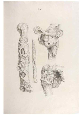 Reproducción/Reproduction 48832832946: Osteographia, or the Anatomy of the Bones.. London,1733.. 