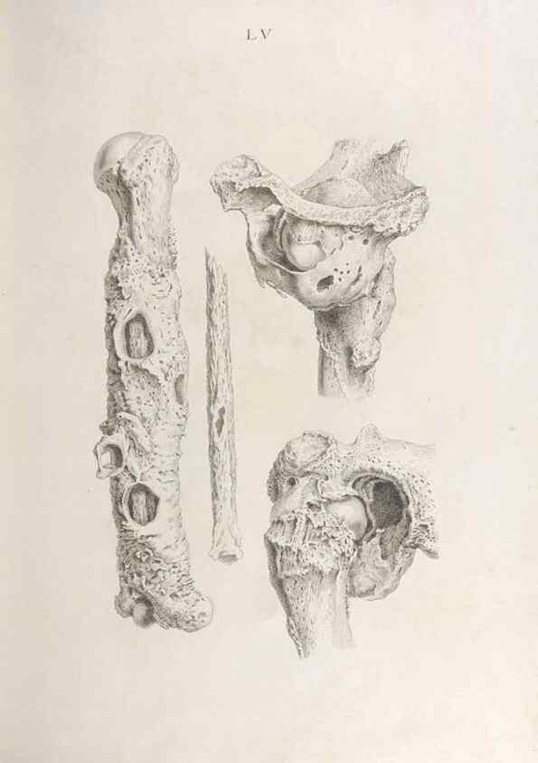 Reproducción/Reproduction 48832832946: Osteographia, or the Anatomy of the Bones.. London,1733.. 