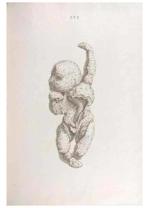 Reproducción/Reproduction 48832833286: Osteographia, or the Anatomy of the Bones.. London,1733.. 