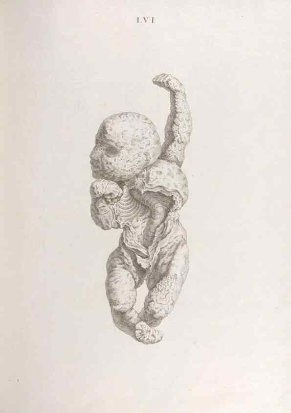 Reproducción/Reproduction 48832833286: Osteographia, or the Anatomy of the Bones.. London,1733.. 