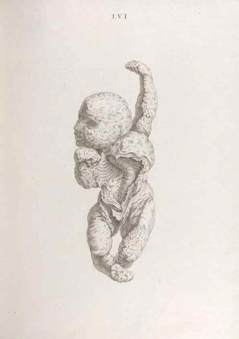Reproducción/Reproduction 48832833286: Osteographia, or the Anatomy of the Bones.. London,1733.. 