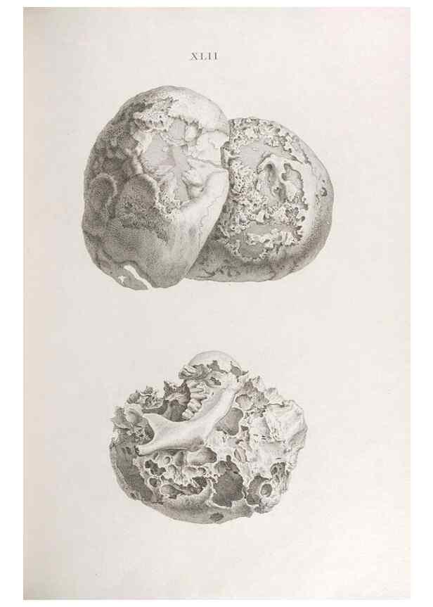 Reproducción/Reproduction 48832827326: Osteographia, or the Anatomy of the Bones.. London,1733.. 