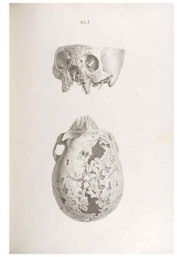 Reproducción/Reproduction 48832827016: Osteographia, or the Anatomy of the Bones.. London,1733.. 