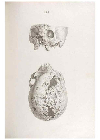Reproducción/Reproduction 48832827016: Osteographia, or the Anatomy of the Bones.. London,1733.. 