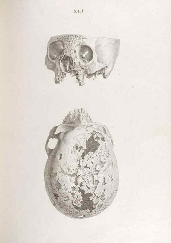 Reproducción/Reproduction 48832827016: Osteographia, or the Anatomy of the Bones.. London,1733.. 