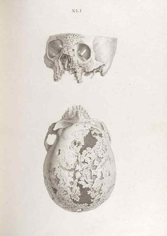 Reproducción/Reproduction 48832827016: Osteographia, or the Anatomy of the Bones.. London,1733.. 