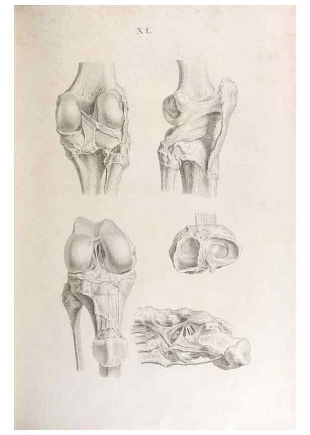 Reproducción/Reproduction 48832996607: Osteographia, or the Anatomy of the Bones.. London,1733.. 