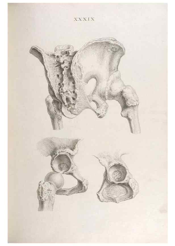 Reproducción/Reproduction 48832826316: Osteographia, or the Anatomy of the Bones.. London,1733.. 