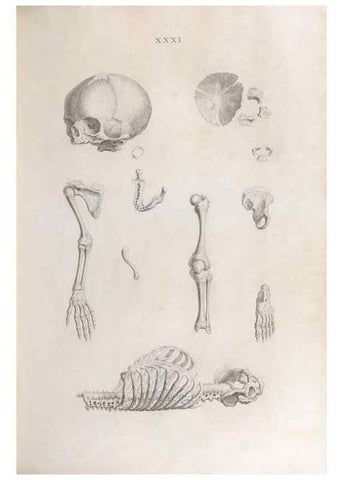 Reproducción/Reproduction 48832458058: Osteographia, or the Anatomy of the Bones.. London,1733.. 