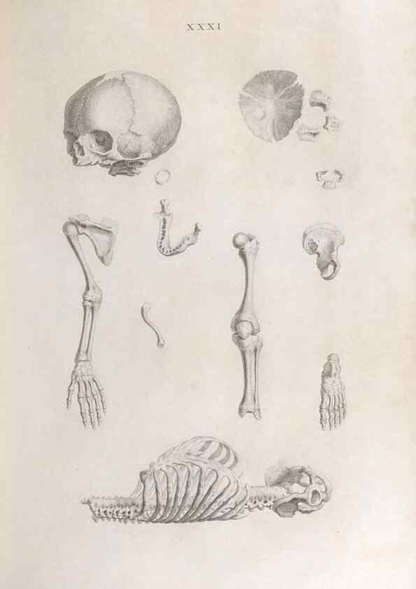 Reproducción/Reproduction 48832458058: Osteographia, or the Anatomy of the Bones.. London,1733.. 