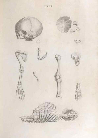 Reproducción/Reproduction 48832458058: Osteographia, or the Anatomy of the Bones.. London,1733.. 