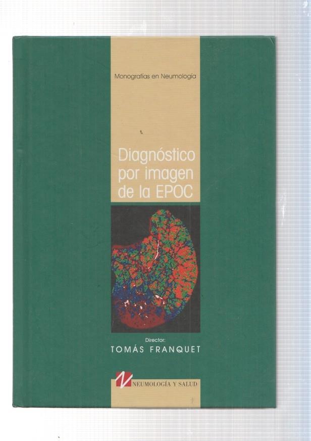 Monografias en Neumologia. Diagnostico por imagen EPOC