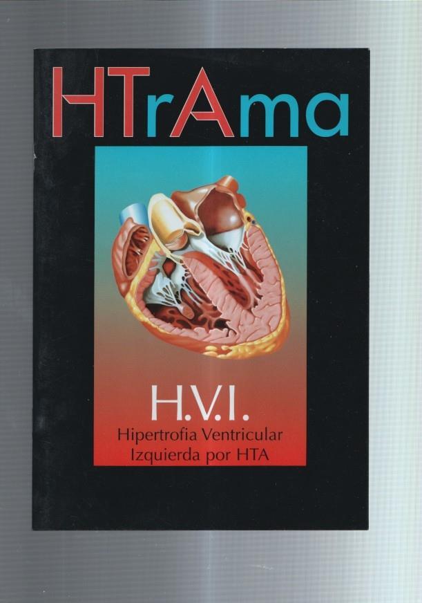 HTrama: H.V.I Hipertrofia ventricular izquierda por HTA