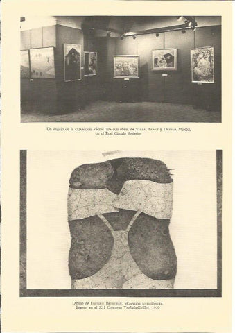 LAMINA V01898: Cuestion teratologica Premio XII Concurso Yngada-Guillot 1970 por E. Brinkman