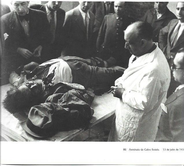 LAMINA 31545: Asesinato de Calvo Sotelo en 1936
