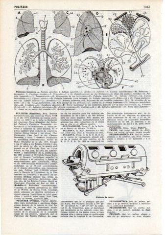 LAMINA V12475: Pulmones humanos y pulmon de acero