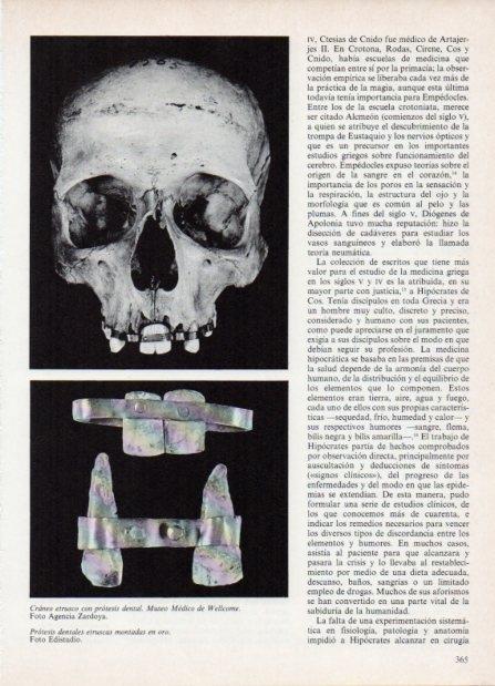LAMINA V18631: Craneo etrusco con protesis dental