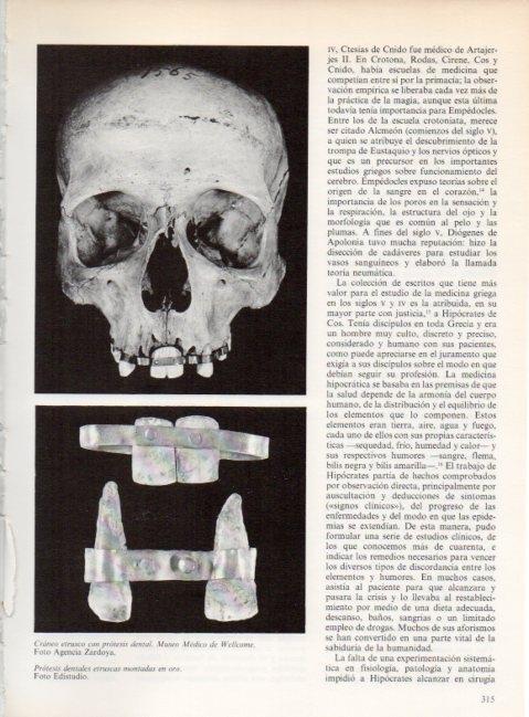 LAMINA V19291: Craneo etrusco con protesis dental