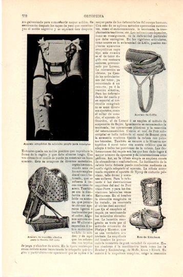 LAMINA V24091: Aparato de Collin y bota de Kirmisson