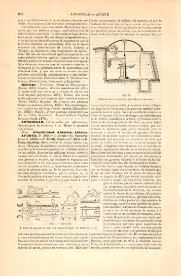 LAMINA V23617: Afustes