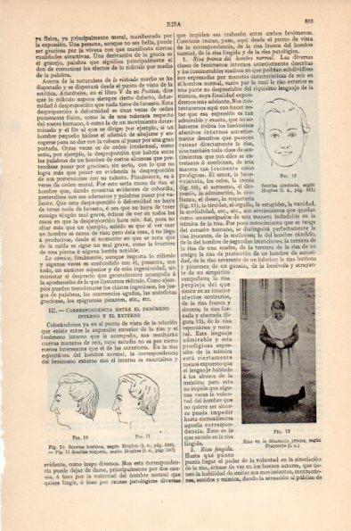 LAMINA V26598: Risa en la demencia precoz