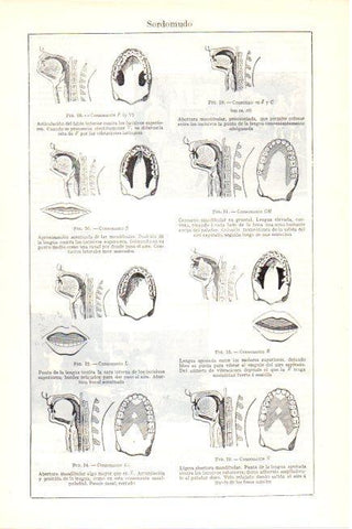 LAMINA V30301: Sordomudo consonantes
