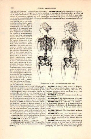 LAMINA V31093: Forma del talle normal y deformada por el corse